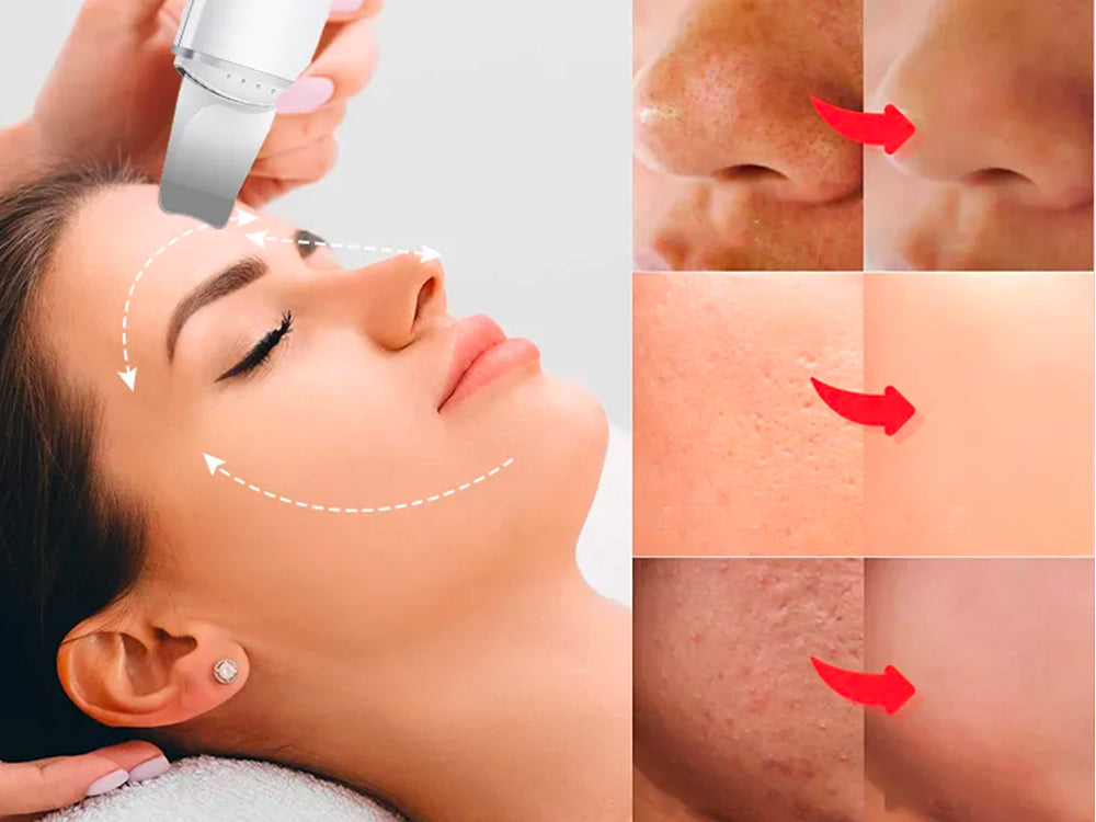 Spatule vibrante anti-impuretés