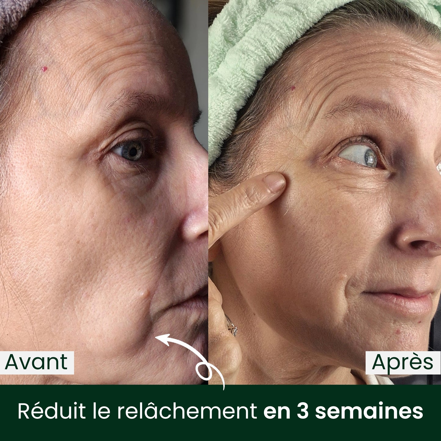 Glow Skin - Ralentissez le temps